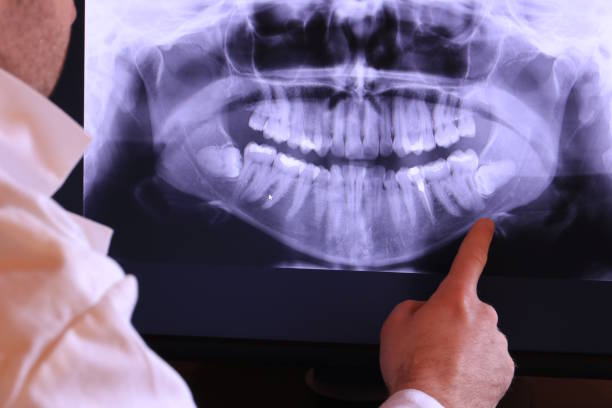 Best Emergency Dental Care for Broken or Chipped Teeth in Valley Falls, KS
