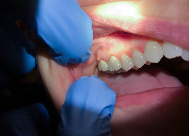 Best Pediatric Emergency Dentist in Valley Falls, KS